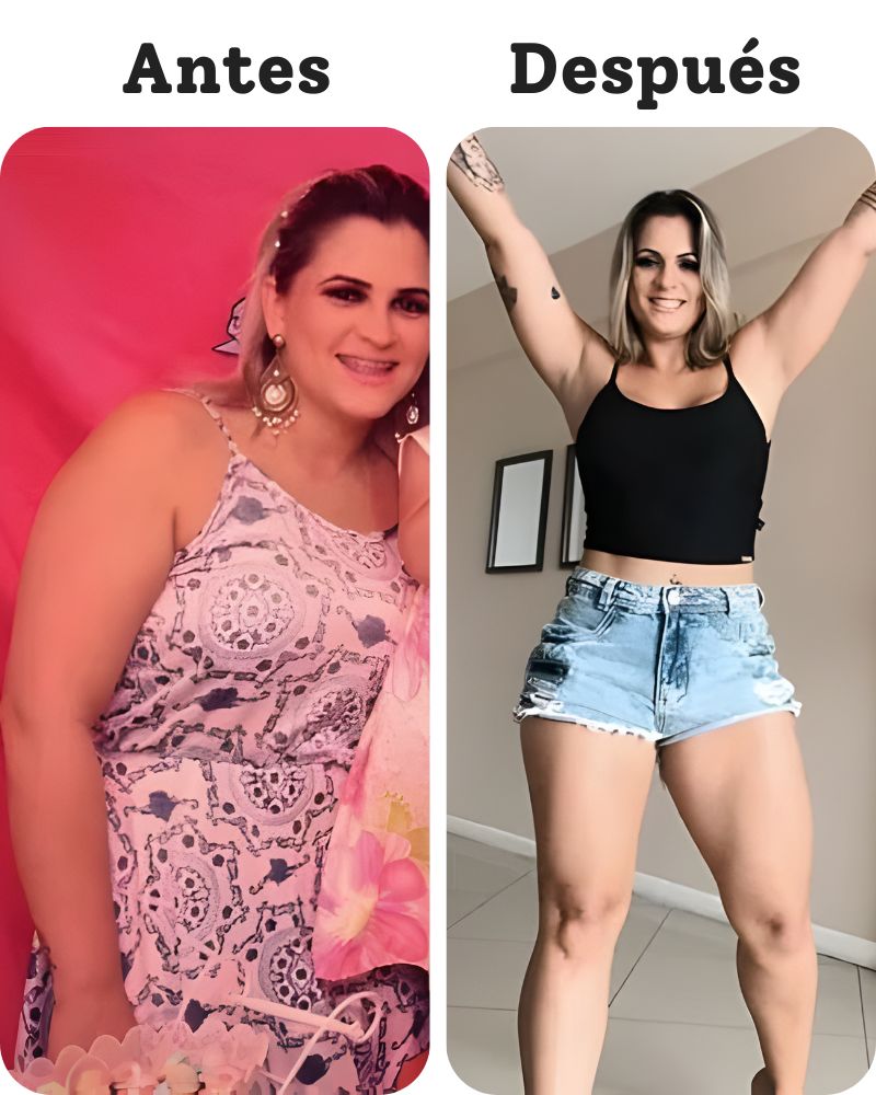 Adriana — Antes y Después