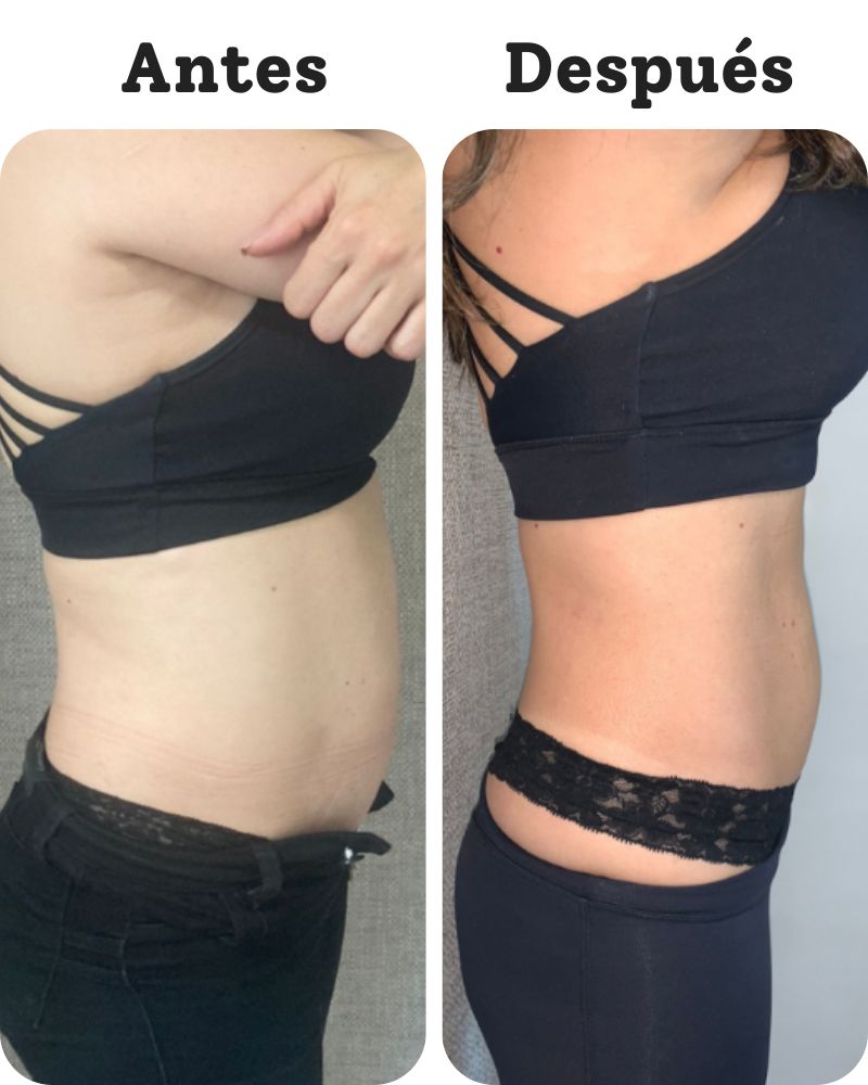 Valentina — Antes y Después