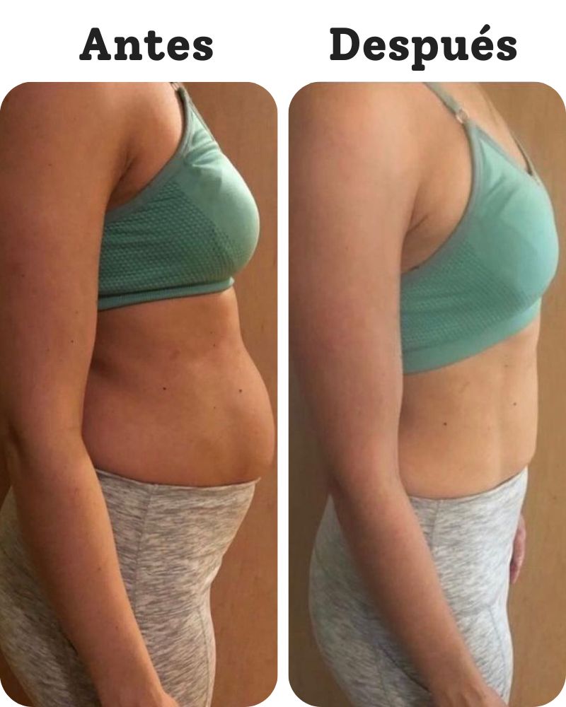 Camila — Antes y Después